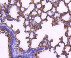 MEK2 Recombinant Rabbit Monoclonal Antibody (SD207-08):Antibodies, Recombinant