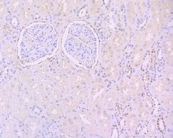Invitrogen Phospho-STAT3 (Tyr705) Recombinant Rabbit Monoclonal Antibody