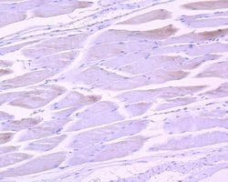 Invitrogen Phospho-STAT3 (Tyr705) Recombinant Rabbit Monoclonal Antibody
