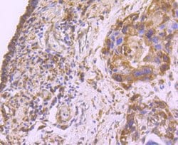 Invitrogen FASN Recombinant Rabbit Monoclonal Antibody (JJ0939) 100 &mu;L;
