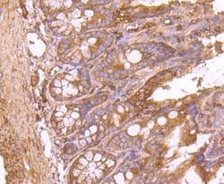 Invitrogen FASN Recombinant Rabbit Monoclonal Antibody (JJ0939) 100 &mu;L;