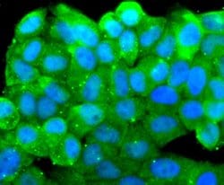 SRC Recombinant Rabbit Monoclonal Antibody (JF0947):Antibodies, Recombinant