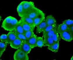 SRC Recombinant Rabbit Monoclonal Antibody (JF0947):Antibodies, Recombinant