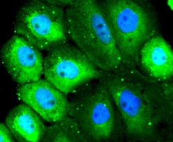 SRC Recombinant Rabbit Monoclonal Antibody (JF0947):Antibodies, Recombinant