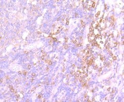 SRC Recombinant Rabbit Monoclonal Antibody (JF0947):Antibodies, Recombinant