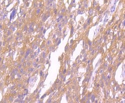 SRC Recombinant Rabbit Monoclonal Antibody (JF0947):Antibodies, Recombinant