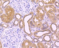 SRC Recombinant Rabbit Monoclonal Antibody (JF0947):Antibodies, Recombinant