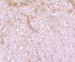 SRC Recombinant Rabbit Monoclonal Antibody (JF0947):Antibodies, Recombinant