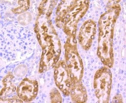 SRC Recombinant Rabbit Monoclonal Antibody (JF0947):Antibodies, Recombinant