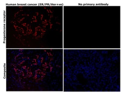 Invitrogen Progesterone Receptor Recombinant Rabbit Monoclonal Antibody