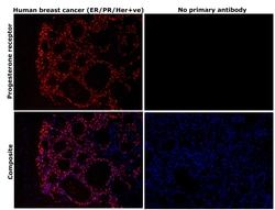 Invitrogen Progesterone Receptor Recombinant Rabbit Monoclonal Antibody