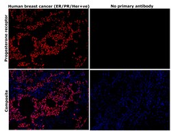 Invitrogen Progesterone Receptor Recombinant Rabbit Monoclonal Antibody
