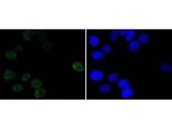 Invitrogen Progesterone Receptor Recombinant Rabbit Monoclonal Antibody