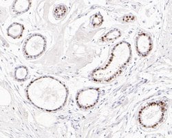 Invitrogen Progesterone Receptor Recombinant Rabbit Monoclonal Antibody