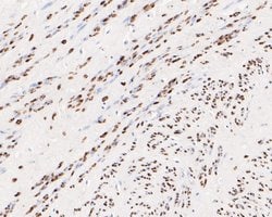 Invitrogen Progesterone Receptor Recombinant Rabbit Monoclonal Antibody