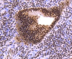 Invitrogen Progesterone Receptor Recombinant Rabbit Monoclonal Antibody