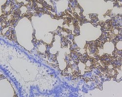 Invitrogen RAGE Recombinant Rabbit Monoclonal Antibody (JF0975) 100 &mu;L;