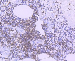 Invitrogen Bcl-2 Recombinant Rabbit Monoclonal Antibody (JF104-8) 100 &mu;L;