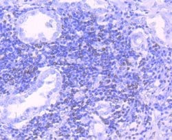 Invitrogen Bcl-2 Recombinant Rabbit Monoclonal Antibody (JF104-8) 100 &mu;L;