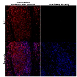 Invitrogen Bcl-2 Recombinant Rabbit Monoclonal Antibody (JF104-8) 100 &mu;L;