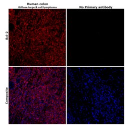 Invitrogen Bcl-2 Recombinant Rabbit Monoclonal Antibody (JF104-8) 100 &mu;L;