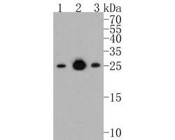 Invitrogen Bcl-2 Recombinant Rabbit Monoclonal Antibody (JF104-8) 100 &mu;L;