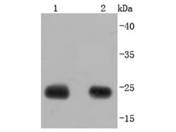 Invitrogen Calbindin D28K Recombinant Rabbit Monoclonal Antibody (JF05-01) 100 &mu;L | Buy Online | Invitrogen&trade; | Fisher Scientific
