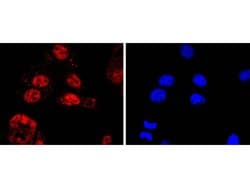 Invitrogen KLF4 Recombinant Rabbit Monoclonal Antibody (JF98-08) 100 &mu;L;