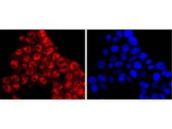 Invitrogen KLF4 Recombinant Rabbit Monoclonal Antibody (JF98-08) 100 &mu;L;