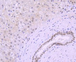 Invitrogen KLF4 Recombinant Rabbit Monoclonal Antibody (JF98-08) 100 &mu;L;