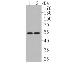 Invitrogen KLF4 Recombinant Rabbit Monoclonal Antibody (JF98-08) 100 &mu;L;