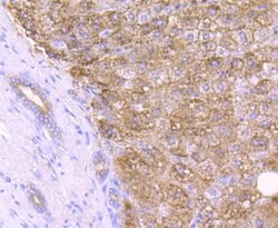 Invitrogen Catalase Recombinant Rabbit Monoclonal Antibody (JM11-12) 100 &mu;L | Buy Online | Invitrogen&trade; | Fisher Scientific