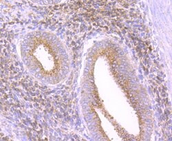 Invitrogen Catalase Recombinant Rabbit Monoclonal Antibody (JM11-12) 100 &mu;L | Buy Online | Invitrogen&trade; | Fisher Scientific