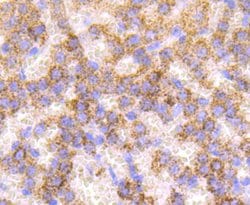 Invitrogen Catalase Recombinant Rabbit Monoclonal Antibody (JM11-12) 100 &mu;L | Buy Online | Invitrogen&trade; | Fisher Scientific