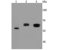 Invitrogen Catalase Recombinant Rabbit Monoclonal Antibody (JM11-12) 100 &mu;L | Buy Online | Invitrogen&trade; | Fisher Scientific