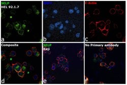 Invitrogen P-Selectin Recombinant Rabbit Monoclonal Antibody (JM10-95) 100 &mu;L | Buy Online | Invitrogen&trade; | Fisher Scientific
