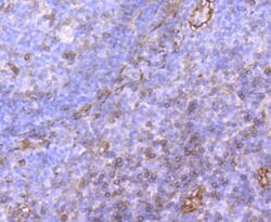 Invitrogen P-Selectin Recombinant Rabbit Monoclonal Antibody (JM10-95) 100 &mu;L | Buy Online | Invitrogen&trade; | Fisher Scientific
