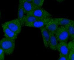 Invitrogen BNIP3 Recombinant Rabbit Monoclonal Antibody (JA71-10) 100 &mu;L | Buy Online | Invitrogen&trade; | Fisher Scientific