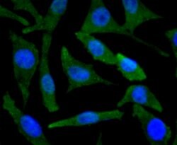 Invitrogen BNIP3 Recombinant Rabbit Monoclonal Antibody (JA71-10) 100 &mu;L | Buy Online | Invitrogen&trade; | Fisher Scientific