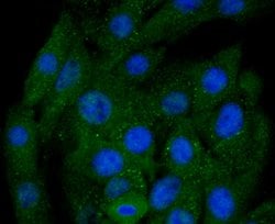 Invitrogen BNIP3 Recombinant Rabbit Monoclonal Antibody (JA71-10) 100 &mu;L | Buy Online | Invitrogen&trade; | Fisher Scientific