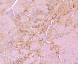 Invitrogen BNIP3 Recombinant Rabbit Monoclonal Antibody (JA71-10) 100 &mu;L | Buy Online | Invitrogen&trade; | Fisher Scientific