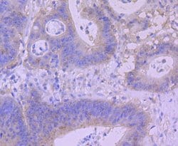 Invitrogen BNIP3 Recombinant Rabbit Monoclonal Antibody (JA71-10) 100 &mu;L | Buy Online | Invitrogen&trade; | Fisher Scientific