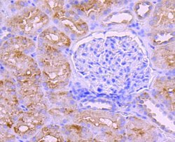 Invitrogen BNIP3 Recombinant Rabbit Monoclonal Antibody (JA71-10) 100 &mu;L | Buy Online | Invitrogen&trade; | Fisher Scientific