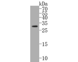 Invitrogen BNIP3 Recombinant Rabbit Monoclonal Antibody (JA71-10) 100 &mu;L | Buy Online | Invitrogen&trade; | Fisher Scientific