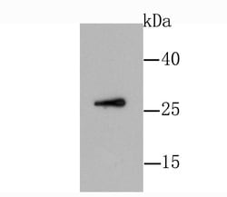 Invitrogen GDNF Recombinant Rabbit Monoclonal Antibody (JA93-10) 100 &mu;L;