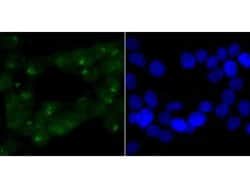 Invitrogen CHD4 Recombinant Rabbit Monoclonal Antibody (JA33-40) 100 &mu;L;