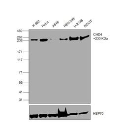 Invitrogen CHD4 Recombinant Rabbit Monoclonal Antibody (JA33-40) 100 &mu;L;