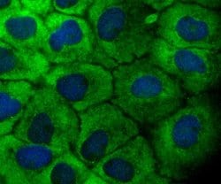 Invitrogen TAK1 Recombinant Rabbit Monoclonal Antibody (JM73-19) 100 &mu;L;