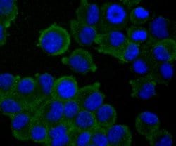 Invitrogen TAK1 Recombinant Rabbit Monoclonal Antibody (JM73-19) 100 &mu;L;