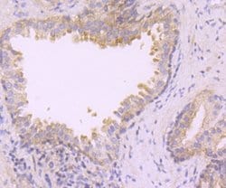 Invitrogen TAK1 Recombinant Rabbit Monoclonal Antibody (JM73-19) 100 &mu;L;